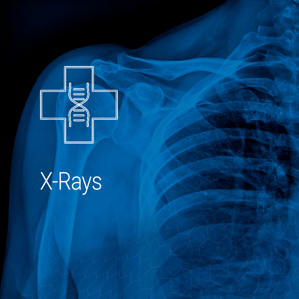 X-ray services